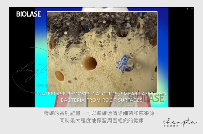 水雷射清除細菌示意圖