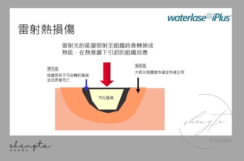 雷射熱損傷示意圖