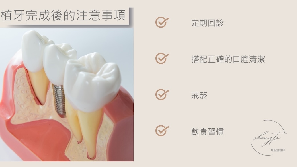 植牙後注意事項，包含定期回診、搭配正確的口腔清潔、戒菸與養成良好飲食習慣